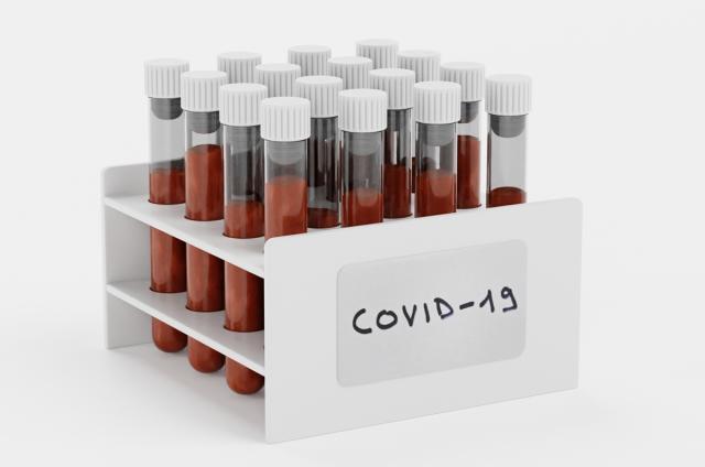 covid-19 test tubes 3d model turbosquid