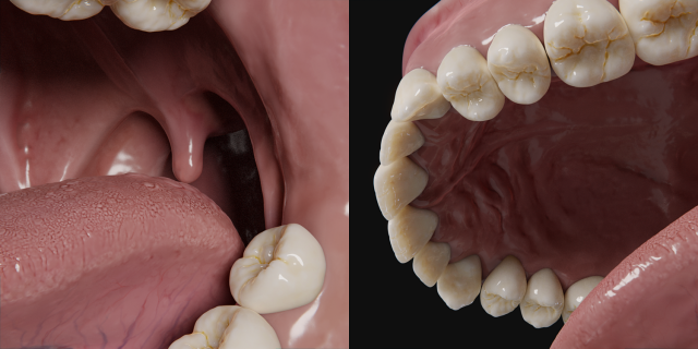gums and teeth 3d model