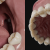 gums and teeth 3d model